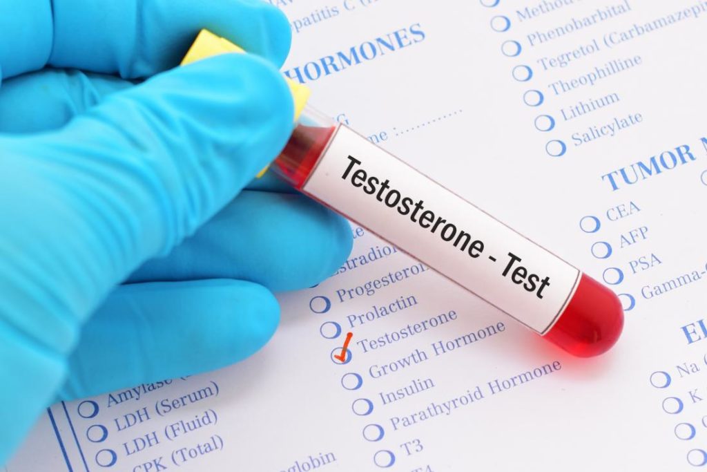 Testosterone test prescribed